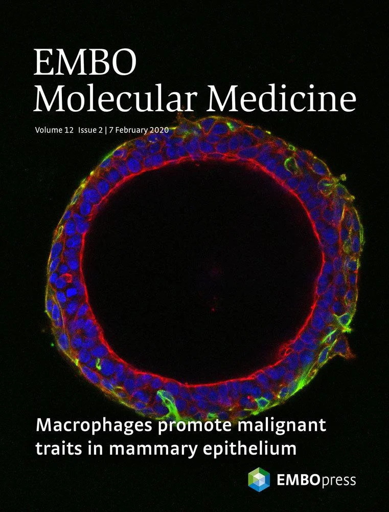 EMBO Molecular Medicine cover (Volume 12, Issue 2, 07 February 2020) with black background scientific image of organoid stained for DNA (blue), F‐actin (red) and alpha‐SMA (green). 