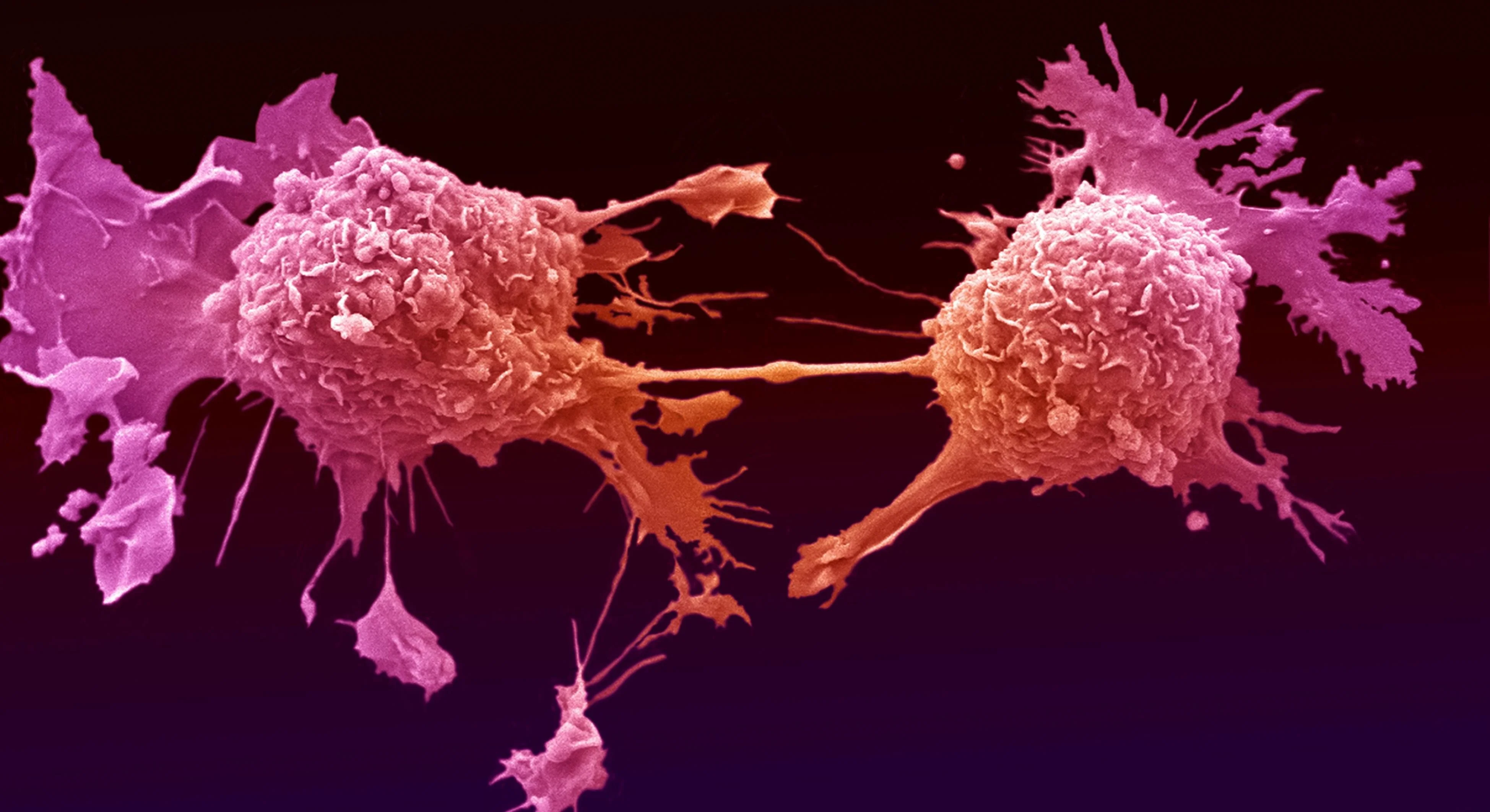 Lung cancer cells dividing. Credit: Anne Weston, Francis Crick Institute. CC BY-NC