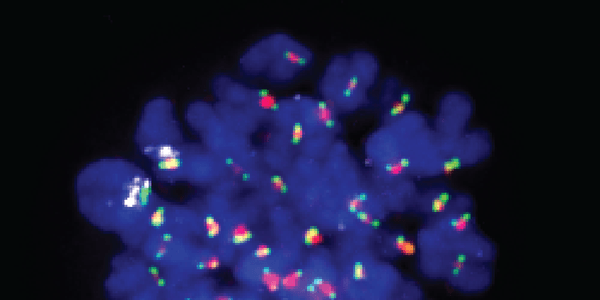Tracking the position and behaviour of individual chromosomes during mitosis. Here chromosome 1 is marked by white fluorescence in-situ hybridisation probes.
