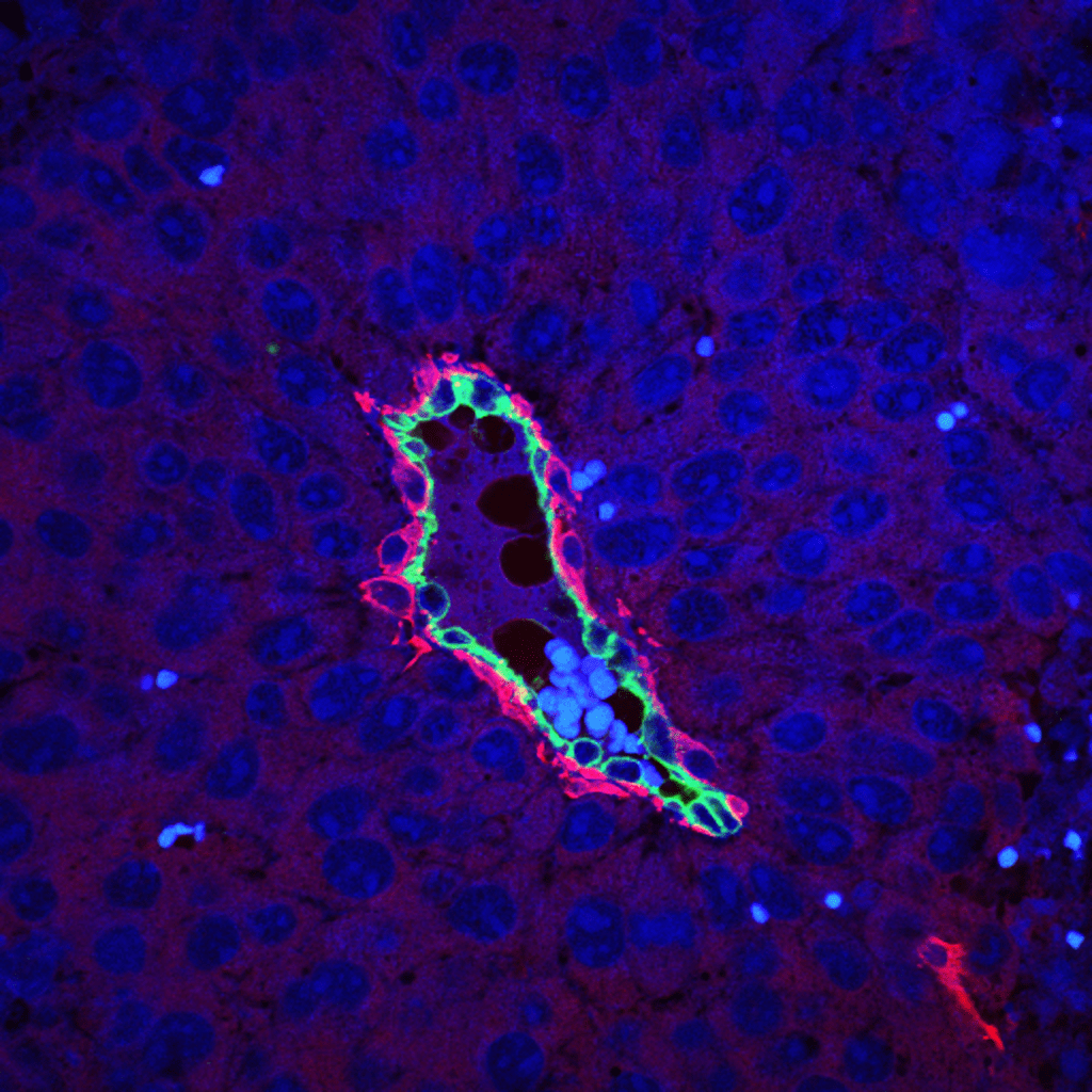 Pericytes: Novel insights into the control of cancer growth. A β3-integrin-negative tumour blood vessel. Mural cells are labelled (red), β3-integrin found only in endothelial cells (green) and nuclei (blue).