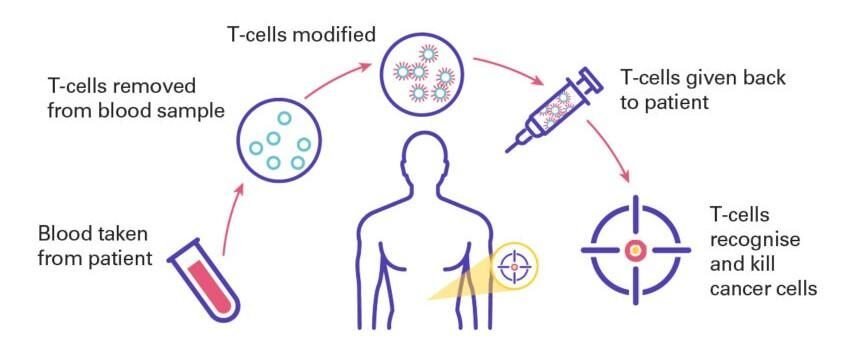 CAR T cell therapy for pancreatic cancer.