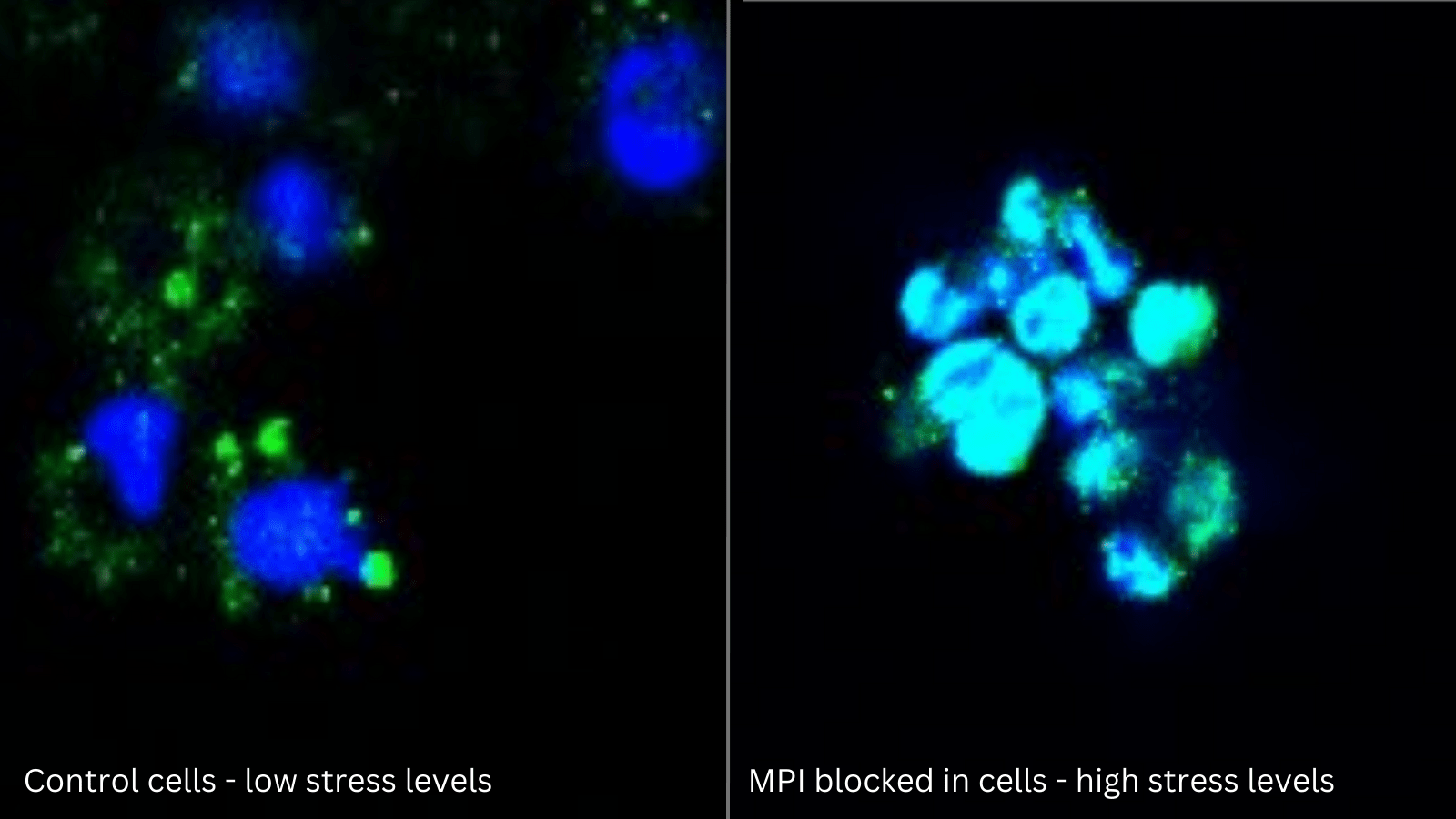 Fluorescence microscope image of cells. Cell nuclei are shown in blue and ATF6, a protein involved in cell stress, is shown in green. When MPI is inhibited, ATF6 moves into the nucleus, demonstrating that the cells are stressed.