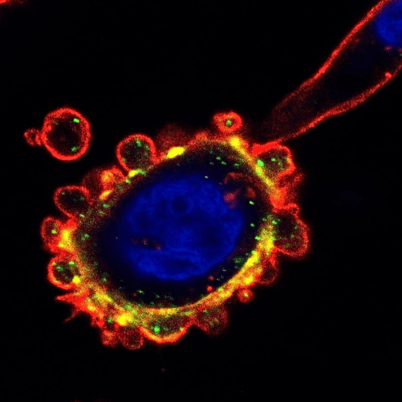Pancreatic amoeboid cell. Blue: nucleus; red: actin cytoskeleton; green: phosphorylated myosin light chain.