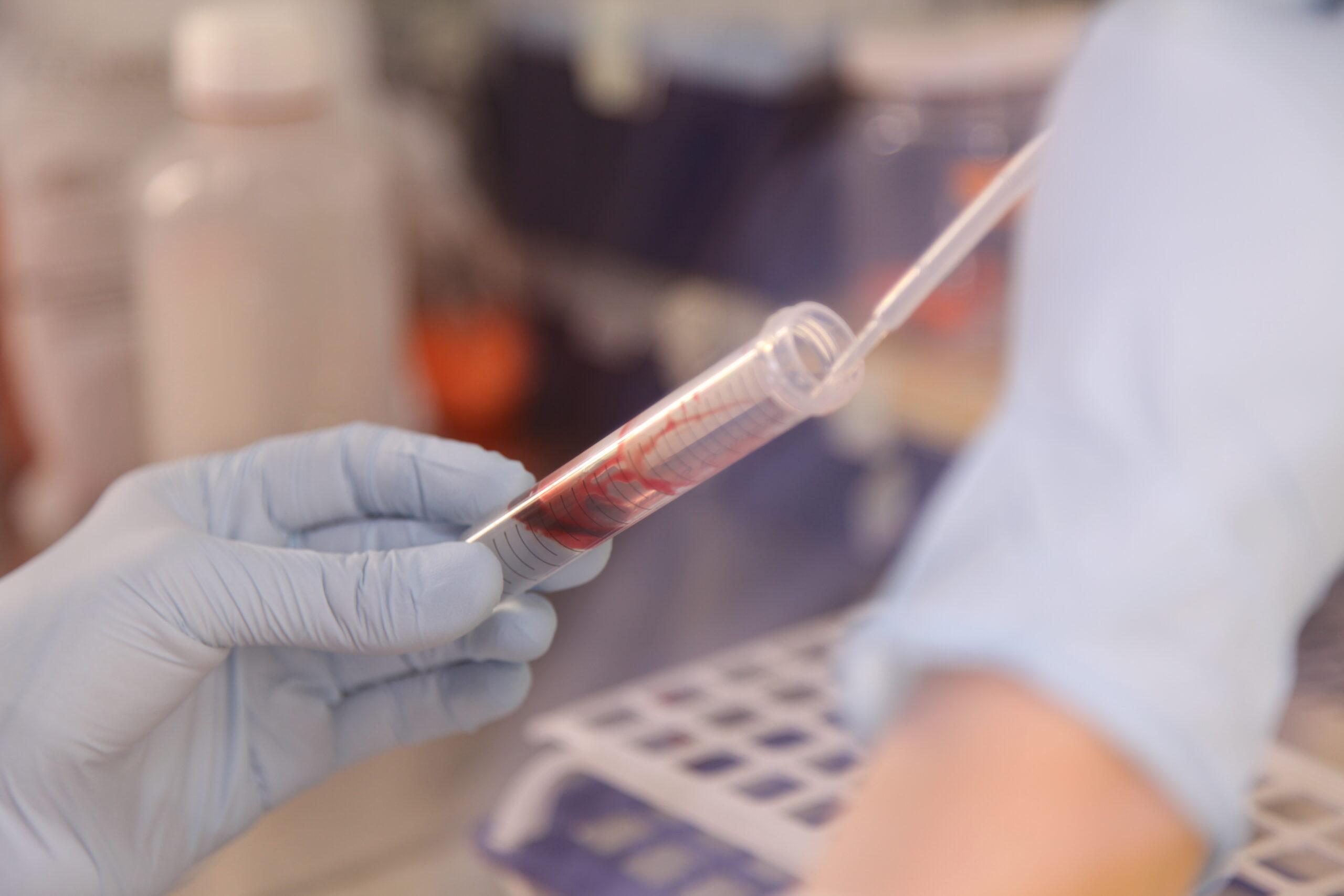 Researcher in the laboratory working with a blood sample in a test tube.