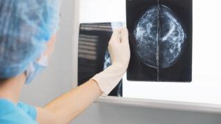 woman doctor or nurse in surgery outfit is holding a mammogram in front of x-ray illuminator